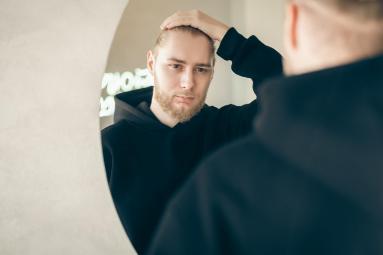Read more about the article Hårtransplantation hos Vince Angels til Lave Priser – Giv Dit Hår Nyt Liv